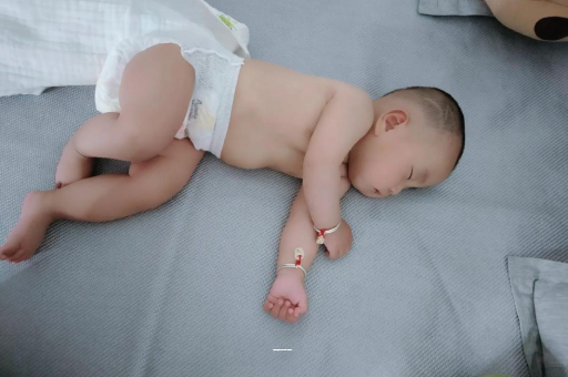 石狮宝宝上火有眼屎